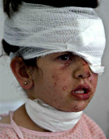 agirl injured in tyre sunday reuters